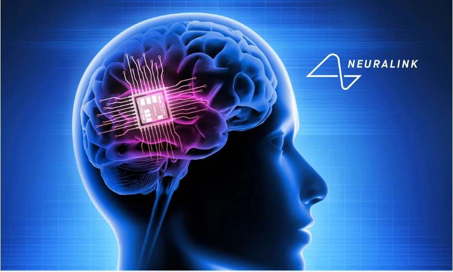 Neuralink Patok Tanam Chip Bagi 1.000 Pasien